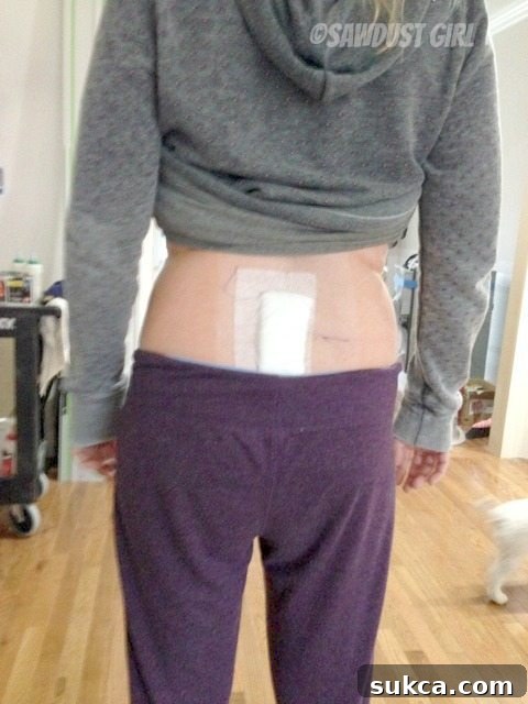 Spinal Repair Diagram of back surgery repair