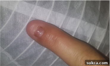 Kristy's almost healed finger after a DIY injury, a testament to recovery and resilience - SawdustGirl.com